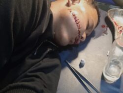 Tidak Terima Anaknya Dianiaya, Seorang Ayah Melapor ke Polres Batubara