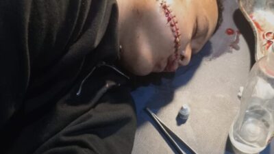 Tidak Terima Anaknya Dianiaya, Seorang Ayah Melapor ke Polres Batubara